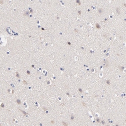 Invitrogen CD268 (BAFF Receptor) Polyclonal Antibody 100 &mu;L; Unconjugated:Antibodies,