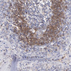Invitrogen CD268 (BAFF Receptor) Polyclonal Antibody 100 &mu;L; Unconjugated:Antibodies,