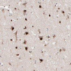 Invitrogen MEIS2 Polyclonal Antibody 100 &mu;L; Unconjugated:Antibodies,