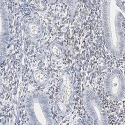 Invitrogen MiTF Polyclonal Antibody 100 &mu;L; Unconjugated:Antibodies,