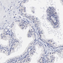 Invitrogen MKP4 Polyclonal Antibody 100 &mu;L; Unconjugated:Antibodies,