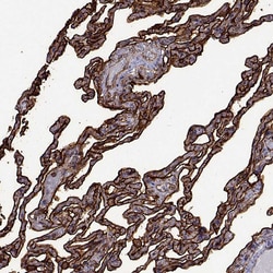 Invitrogen S100A10 Polyclonal Antibody 100 &mu;L; Unconjugated:Antibodies,