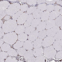 Invitrogen S100A10 Polyclonal Antibody 100 &mu;L; Unconjugated:Antibodies,
