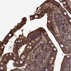Invitrogen S100A10 Polyclonal Antibody 100 &mu;L; Unconjugated:Antibodies,