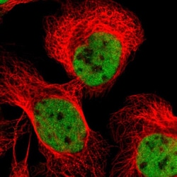 Invitrogen FBXO44 Polyclonal Antibody 100 &mu;L; Unconjugated:Antibodies,