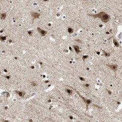 Invitrogen FBXO44 Polyclonal Antibody 100 &mu;L; Unconjugated:Antibodies,