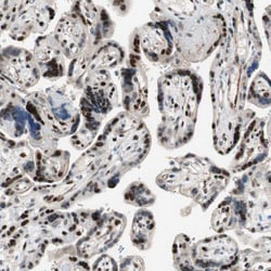Invitrogen FBXO44 Polyclonal Antibody 100 &mu;L; Unconjugated:Antibodies,