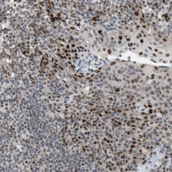 Invitrogen FBXO44 Polyclonal Antibody 100 &mu;L; Unconjugated:Antibodies,