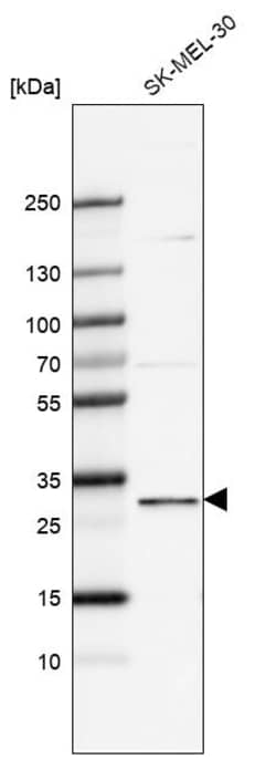 Invitrogen FBXO44 Polyclonal Antibody 100 &mu;L; Unconjugated:Antibodies,