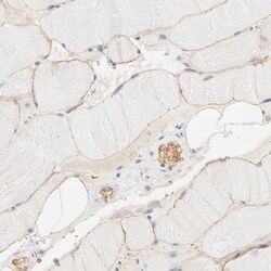 Invitrogen SPTB Polyclonal Antibody 100 &mu;L; Unconjugated:Antibodies,