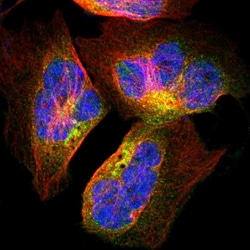 Invitrogen SPTB Polyclonal Antibody 100 &mu;L; Unconjugated:Antibodies,