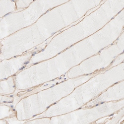 Invitrogen SPTB Polyclonal Antibody 100 &mu;L; Unconjugated:Antibodies,