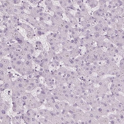 Invitrogen TFF1 Polyclonal Antibody 100 &mu;L; Unconjugated:Antibodies,