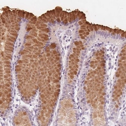 Invitrogen TFF1 Polyclonal Antibody 100 &mu;L; Unconjugated:Antibodies,
