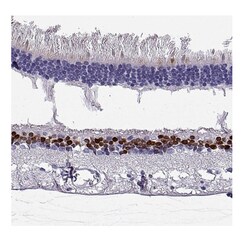 Invitrogen CHX10 Polyclonal Antibody 100 &mu;L; Unconjugated:Antibodies,