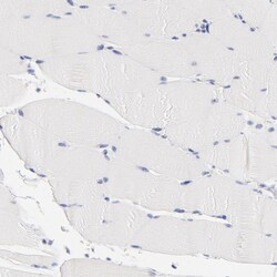 Invitrogen CHX10 Polyclonal Antibody 100 &mu;L; Unconjugated:Antibodies,