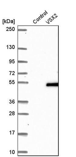 Invitrogen CHX10 Polyclonal Antibody 100 &mu;L; Unconjugated:Antibodies,