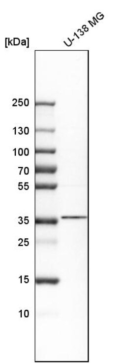 Invitrogen Nkx2.2 Polyclonal Antibody 100 &mu;L; Unconjugated:Antikroppar