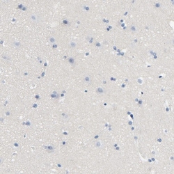 Invitrogen LCK Polyclonal Antibody 100 &mu;L | Buy Online | Invitrogen&trade; | Fisher Scientific