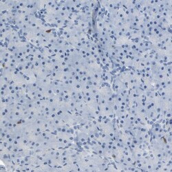 Invitrogen LCK Polyclonal Antibody 100 &mu;L | Buy Online | Invitrogen&trade; | Fisher Scientific