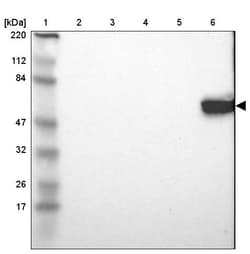Invitrogen LCK Polyclonal Antibody 100 &mu;L | Buy Online | Invitrogen&trade; | Fisher Scientific