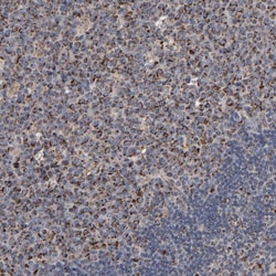 Invitrogen UQCRC1 Polyclonal Antibody 100 &mu;L; Unconjugated:Antibodies,