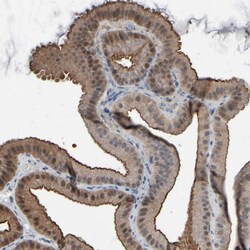Invitrogen GPX2 Polyclonal Antibody 100 &mu;L; Unconjugated:Antibodies,