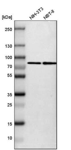 Invitrogen SETD3 Polyclonal Antibody 100 &mu;L; Unconjugated:Antibodies,