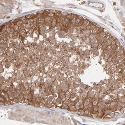 Invitrogen EB1 Polyclonal Antibody 100 &mu;L; Unconjugated:Antibodies,