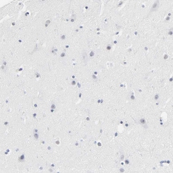 Invitrogen SERPINA4 Polyclonal Antibody 100 &mu;L; Unconjugated:Antibodies,