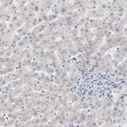 Invitrogen SERPINA4 Polyclonal Antibody 100 &mu;L; Unconjugated:Antibodies,