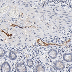 Invitrogen SERPINA4 Polyclonal Antibody 100 &mu;L; Unconjugated:Antibodies,