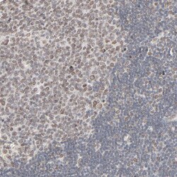 Invitrogen MAD1 Polyclonal Antibody 100 &mu;L; Unconjugated:Antibodies,