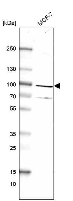 Invitrogen MAD1 Polyclonal Antibody 100 &mu;L; Unconjugated:Antibodies,