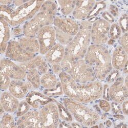 Invitrogen SETD3 Polyclonal Antibody 100 &mu;L; Unconjugated:Antibodies,