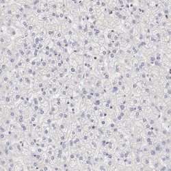 Invitrogen SETD3 Polyclonal Antibody 100 &mu;L; Unconjugated:Antibodies,