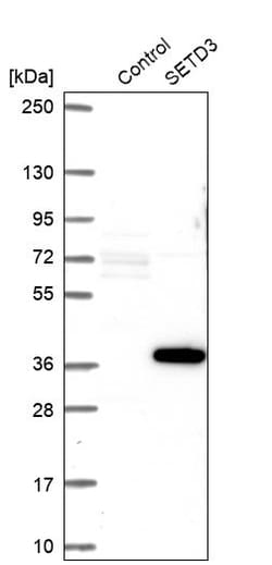 Invitrogen SETD3 Polyclonal Antibody 100 &mu;L; Unconjugated:Antibodies,