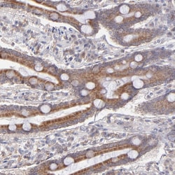Invitrogen OAS1 Polyclonal Antibody 100 &mu;L; Unconjugated:Antibodies,