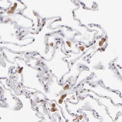 Invitrogen OAS1 Polyclonal Antibody 100 &mu;L; Unconjugated:Antibodies,