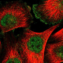 Invitrogen CD90 Polyclonal Antibody 100 &mu;L; Unconjugated:Antibodies,