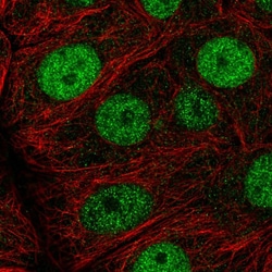 Invitrogen MCM7 Polyclonal Antibody 100 &mu;L; Unconjugated:Antibodies,