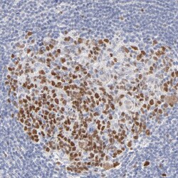 Invitrogen MCM7 Polyclonal Antibody 100 &mu;L; Unconjugated:Antibodies,