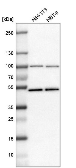 Invitrogen MCM7 Polyclonal Antibody 100 &mu;L | Buy Online | Invitrogen&trade; | Fisher Scientific