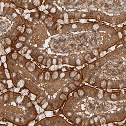 Invitrogen RSK4 Polyclonal Antibody 100 &mu;L; Unconjugated:Antibodies,