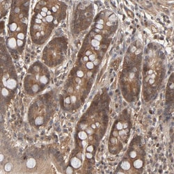 Invitrogen Cdc37 Polyclonal Antibody 100 &mu;L; Unconjugated:Antibodies,