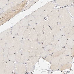 Invitrogen Laminin beta-1 Polyclonal Antibody 100 &mu;L; Unconjugated:Antibodies,