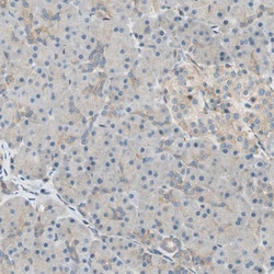 Invitrogen PI4K2B Polyclonal Antibody 100 &mu;L; Unconjugated:Antibodies,