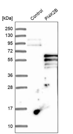 Invitrogen PI4K2B Polyclonal Antibody 100 &mu;L; Unconjugated:Antibodies,