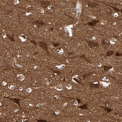 Invitrogen WAVE1 Polyclonal Antibody 100 &mu;L; Unconjugated:Antibodies,