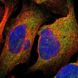 TSPAN6 Polyclonal Antibody, Invitrogen 100 &mu;L | Buy Online | Thermo Fisher Scientific | Fisher Scientific